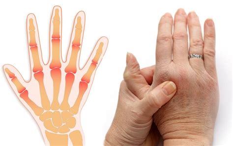 Диагноз - причины боли в суставах пальцев рук